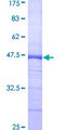 MPS1 / TTK Protein - 12.5% SDS-PAGE Stained with Coomassie Blue.