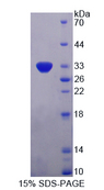 MPS1 / TTK Protein - Recombinant  TTK Protein Kinase By SDS-PAGE