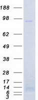 MPS1 / TTK Protein - Purified recombinant protein TTK was analyzed by SDS-PAGE gel and Coomassie Blue Staining
