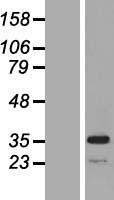 MPST Protein - Western validation with an anti-DDK antibody * L: Control HEK293 lysate R: Over-expression lysate