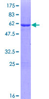 MPST Protein - 12.5% SDS-PAGE of human MPST stained with Coomassie Blue