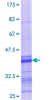 MPST Protein - 12.5% SDS-PAGE Stained with Coomassie Blue.