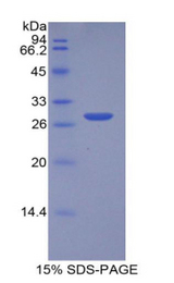 MPST Protein - Recombinant Mercaptopyruvate Sulfurtransferase By SDS-PAGE