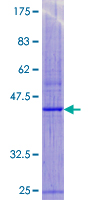 MPV17 Protein - 12.5% SDS-PAGE of human MPV17 stained with Coomassie Blue
