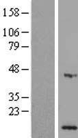 MPV17L Protein - Western validation with an anti-DDK antibody * L: Control HEK293 lysate R: Over-expression lysate