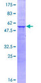MPZ / P0 Protein - 12.5% SDS-PAGE of human MPZ stained with Coomassie Blue