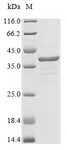 MPZ / P0 Protein - (Tris-Glycine gel) Discontinuous SDS-PAGE (reduced) with 5% enrichment gel and 15% separation gel.