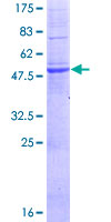 MPZL2 Protein - 12.5% SDS-PAGE of human MPZL2 stained with Coomassie Blue