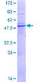 MPZL2 Protein - 12.5% SDS-PAGE of human MPZL2 stained with Coomassie Blue