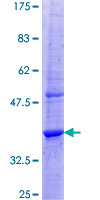 MPZL2 Protein - 12.5% SDS-PAGE Stained with Coomassie Blue.
