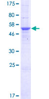 MPZL3 Protein - 12.5% SDS-PAGE of human MPZL3 stained with Coomassie Blue