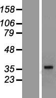 MR1 Protein - Western validation with an anti-DDK antibody * L: Control HEK293 lysate R: Over-expression lysate