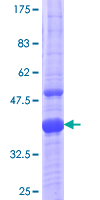 MR1 Protein - 12.5% SDS-PAGE Stained with Coomassie Blue.