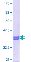 MRAP Protein - 12.5% SDS-PAGE Stained with Coomassie Blue.