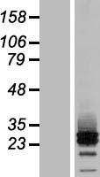 MRAP2 Protein - Western validation with an anti-DDK antibody * L: Control HEK293 lysate R: Over-expression lysate