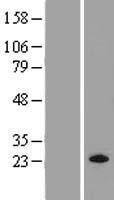 MRAS Protein - Western validation with an anti-DDK antibody * L: Control HEK293 lysate R: Over-expression lysate