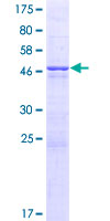 MRAS Protein - 12.5% SDS-PAGE of human MRAS stained with Coomassie Blue