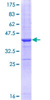 MRC2 / Endo180 Protein - 12.5% SDS-PAGE Stained with Coomassie Blue