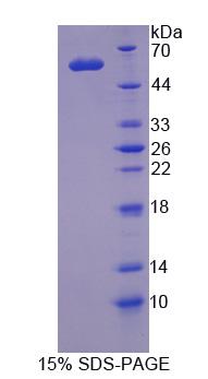 MRE11A / MRE11 Protein - Recombinant  Meiotic Recombination 11 Homolog A By SDS-PAGE