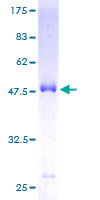 MREG Protein - 12.5% SDS-PAGE of human DSU stained with Coomassie Blue