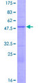 MRGBP Protein - 12.5% SDS-PAGE of human C20orf20 stained with Coomassie Blue