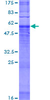 MRGD / MRGPRD Protein - 12.5% SDS-PAGE of human MRGPRD stained with Coomassie Blue