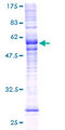 MRGPRX2 / MRGX2 Protein - 12.5% SDS-PAGE of human MRGX2 stained with Coomassie Blue