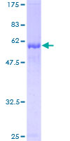 MRI1 Protein - 12.5% SDS-PAGE of human MGC3207 stained with Coomassie Blue