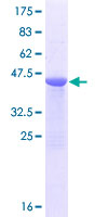 MRLC2 / MYL12B Protein - 12.5% SDS-PAGE of human MRLC2 stained with Coomassie Blue