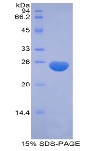 MRLC2 / MYL12B Protein - Recombinant Myosin Light Chain 12B By SDS-PAGE