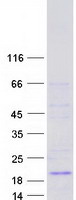 MRLC2 / MYL12B Protein - Purified recombinant protein MYL12B was analyzed by SDS-PAGE gel and Coomassie Blue Staining