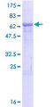 MRM1 Protein - 12.5% SDS-PAGE of human MRM1 stained with Coomassie Blue