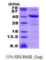 MRM1 Protein