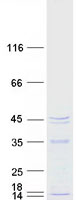 MRM1 Protein - Purified recombinant protein MRM1 was analyzed by SDS-PAGE gel and Coomassie Blue Staining