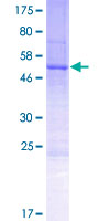 MRO Protein - 12.5% SDS-PAGE of human MRO stained with Coomassie Blue