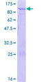 MROH8 Protein - 12.5% SDS-PAGE of human C20orf132 stained with Coomassie Blue