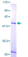 MRPL10 Protein - 12.5% SDS-PAGE of human MRPL10 stained with Coomassie Blue