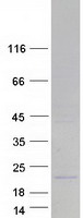 MRPL11 Protein - Purified recombinant protein MRPL11 was analyzed by SDS-PAGE gel and Coomassie Blue Staining
