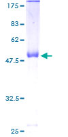 MRPL12 Protein - 12.5% SDS-PAGE of human MRPL12 stained with Coomassie Blue