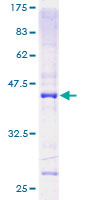 MRPL13 Protein - 12.5% SDS-PAGE of human MRPL13 stained with Coomassie Blue