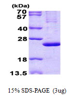 MRPL13 Protein