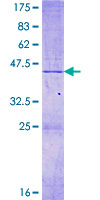 MRPL14 Protein - 12.5% SDS-PAGE of human MRPL14 stained with Coomassie Blue
