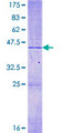 MRPL14 Protein - 12.5% SDS-PAGE of human MRPL14 stained with Coomassie Blue