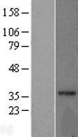 MRPL15 Protein - Western validation with an anti-DDK antibody * L: Control HEK293 lysate R: Over-expression lysate