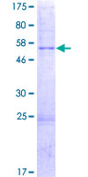 MRPL16 Protein - 12.5% SDS-PAGE of human MRPL16 stained with Coomassie Blue