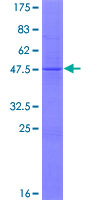 MRPL18 Protein - 12.5% SDS-PAGE of human MRPL18 stained with Coomassie Blue