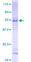 MRPL19 Protein - 12.5% SDS-PAGE of human MRPL19 stained with Coomassie Blue