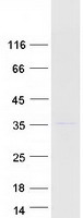 MRPL19 Protein - Purified recombinant protein MRPL19 was analyzed by SDS-PAGE gel and Coomassie Blue Staining