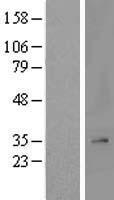 MRPL2 Protein - Western validation with an anti-DDK antibody * L: Control HEK293 lysate R: Over-expression lysate