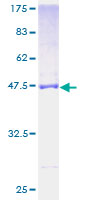 MRPL21 Protein - 12.5% SDS-PAGE of human MRPL21 stained with Coomassie Blue